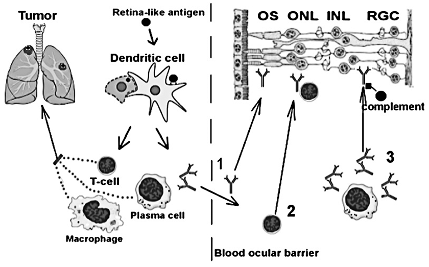 IMR Image