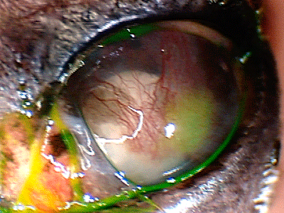 chronic inflammation glaucoma