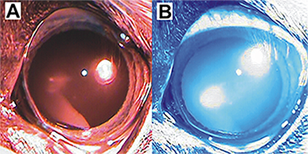 optic nerve disease