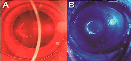 retinal response